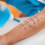 Allergy Testing